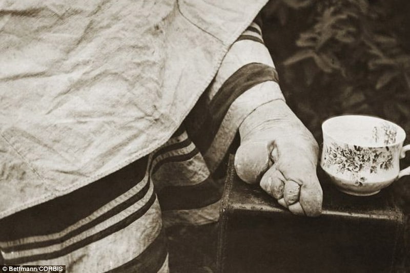 Bound Feet