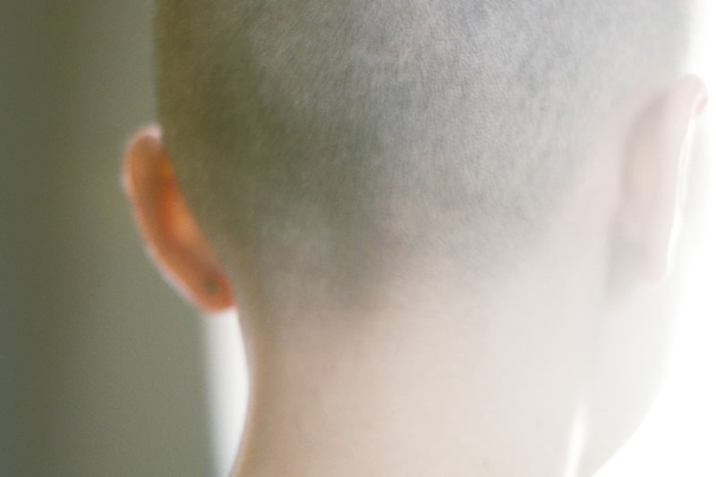 Back view of a Bald Female